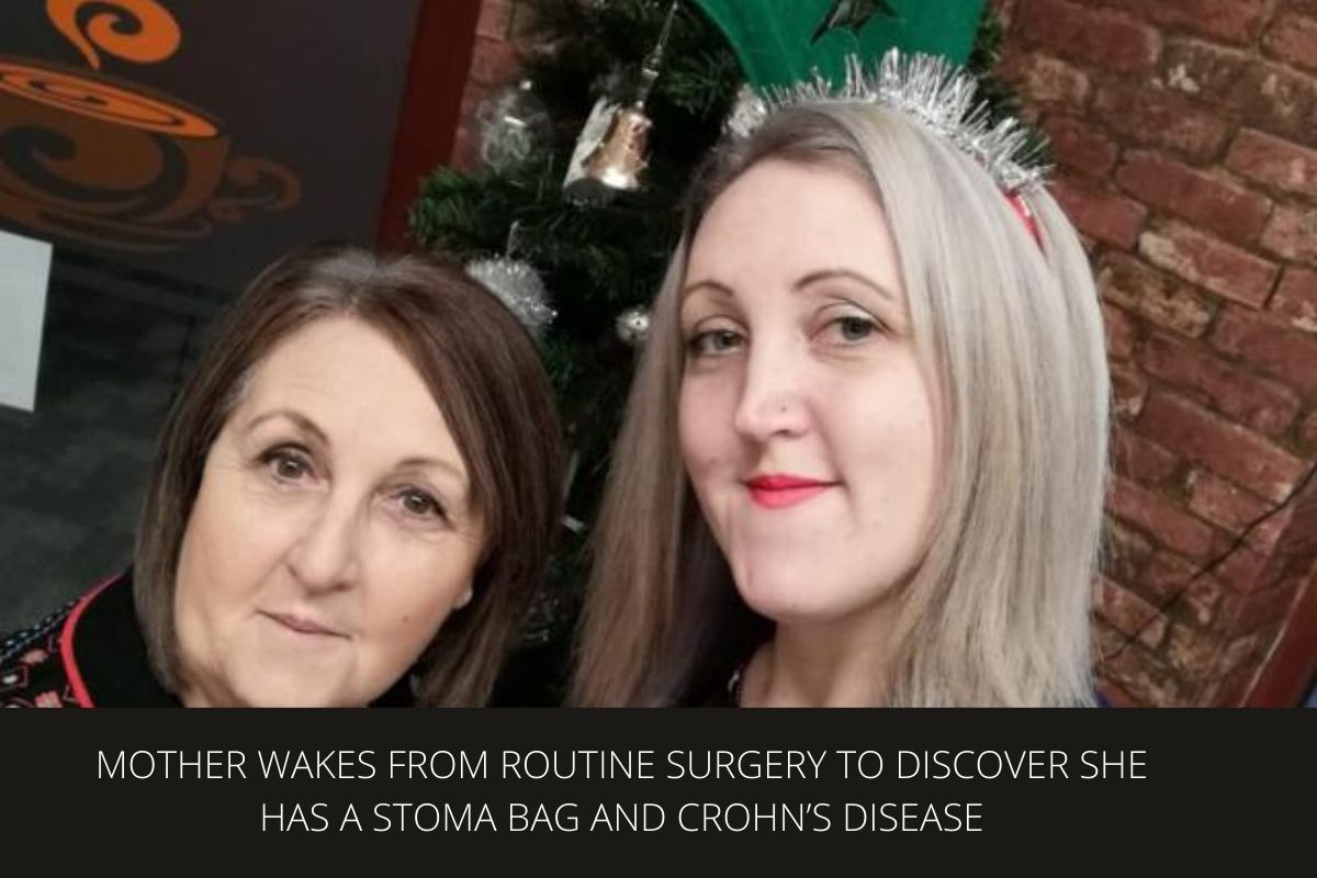 MOTHER WAKES FROM ROUTINE SURGERY TO DISCOVER SHE HAS A STOMA BAG AND CROHN’S DISEASE