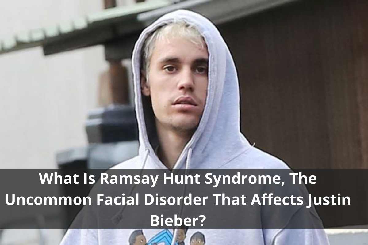 What Is Ramsay Hunt Syndrome, The Uncommon Facial Disorder That Affects Justin Bieber?