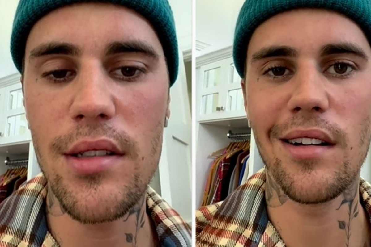 What Is Ramsay Hunt Syndrome, The Uncommon Facial Disorder That Affects Justin Bieber?