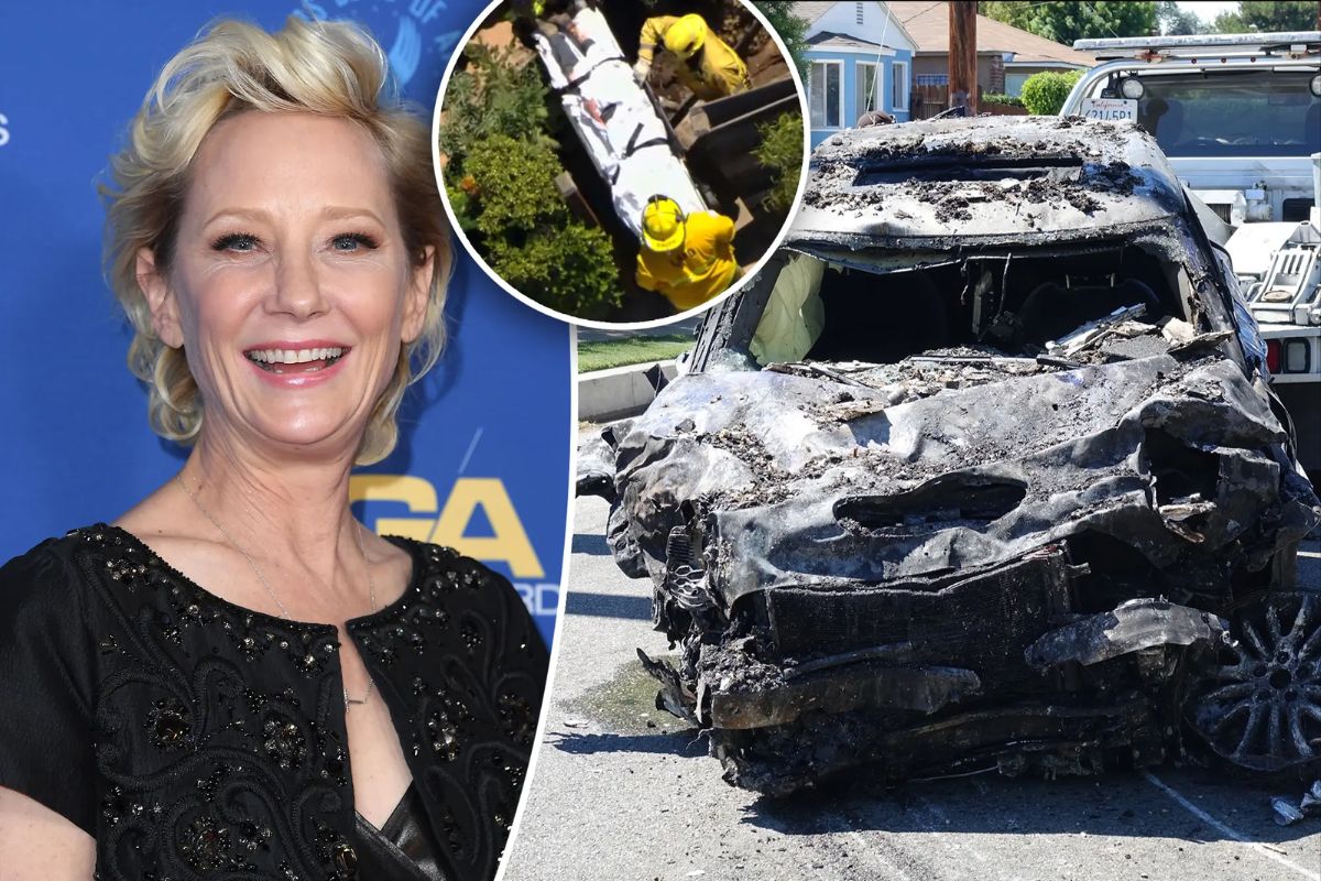 Anne Heche ‘Not Expected To Survive’ After Suffering Brain Injury in Car Crash 