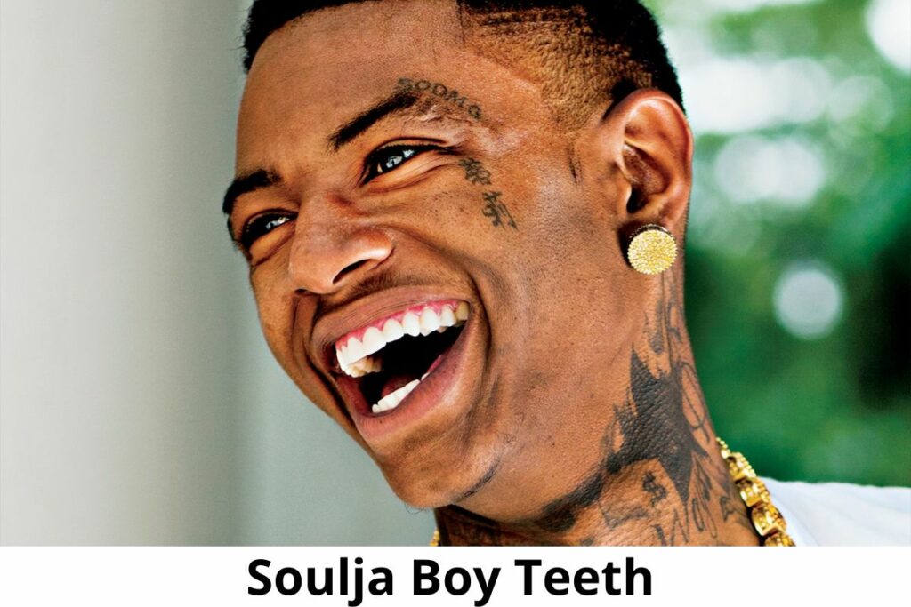 Soulja Boy Teeth