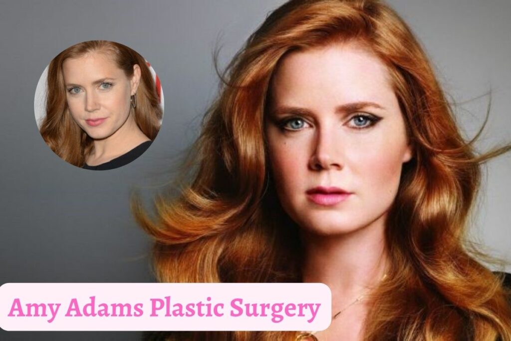 Amy Adams Plastic Surgery