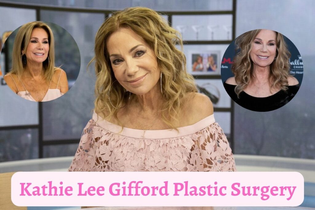 Kathie Lee Gifford Plastic Surgery
