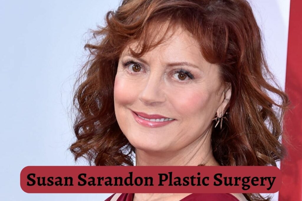 Susan Sarandon Plastic Surgery