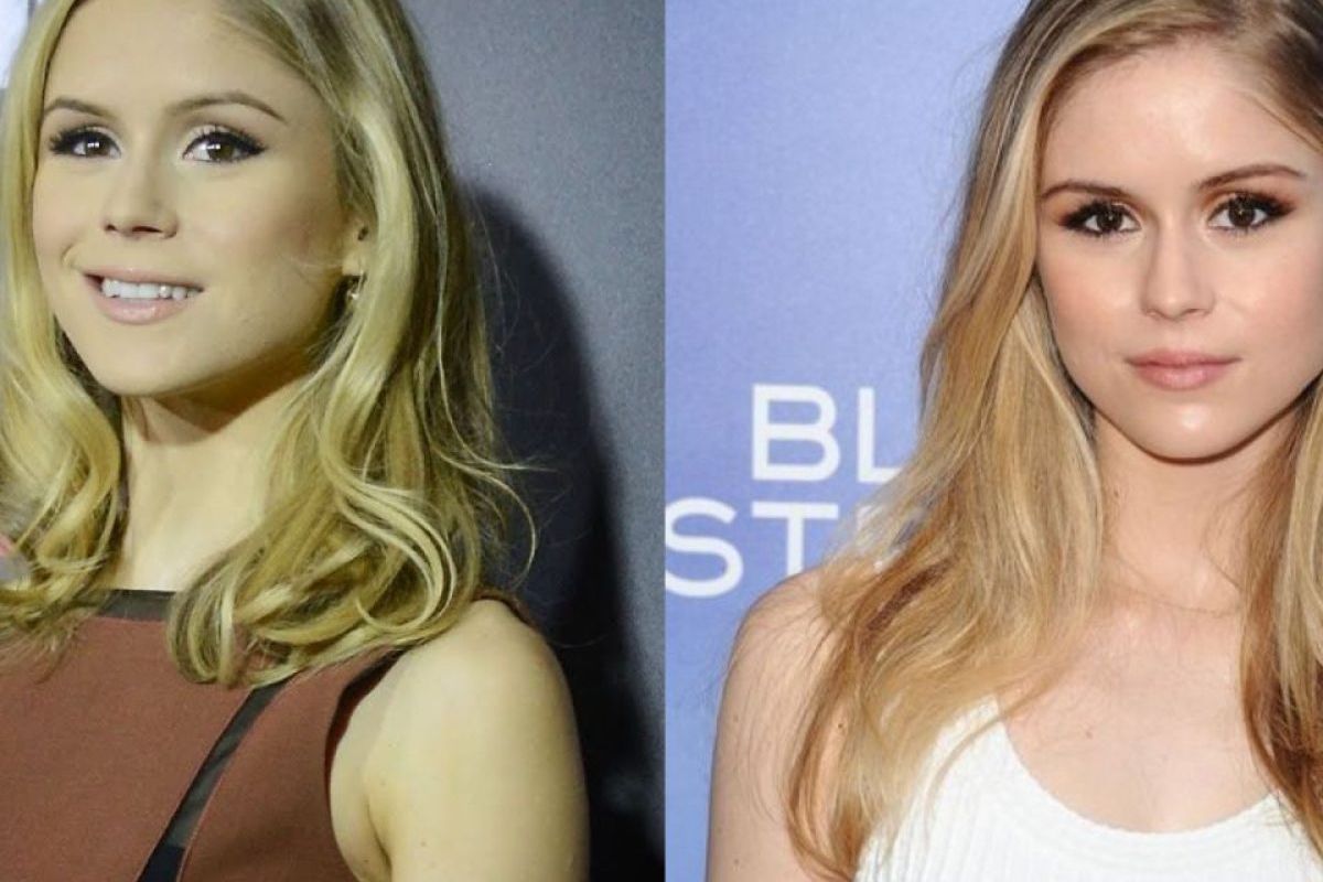 Did Erin Moriarty Get Plastic Surgery
