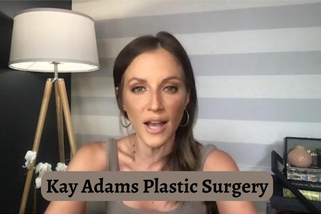 kay adams plastic surgery