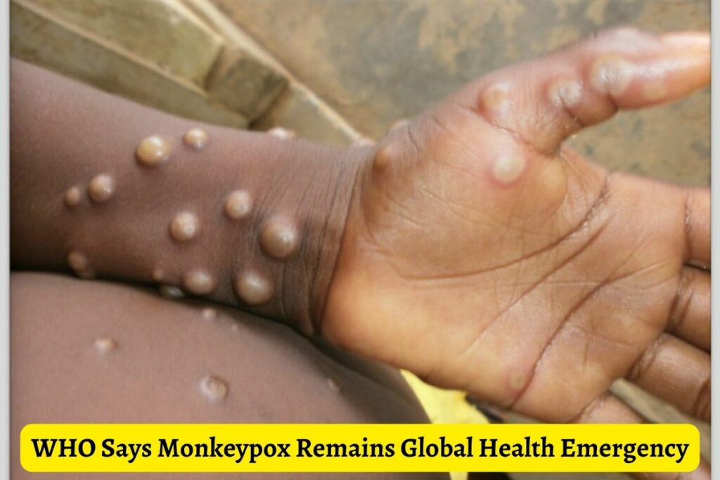 WHO Says Monkeypox Remains Global Health Emergency