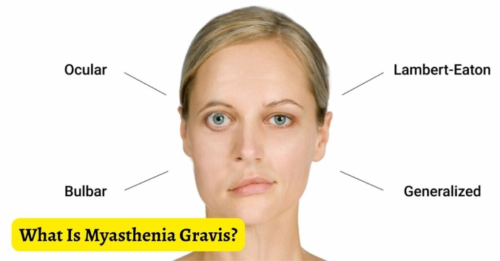 What Is Myasthenia Gravis