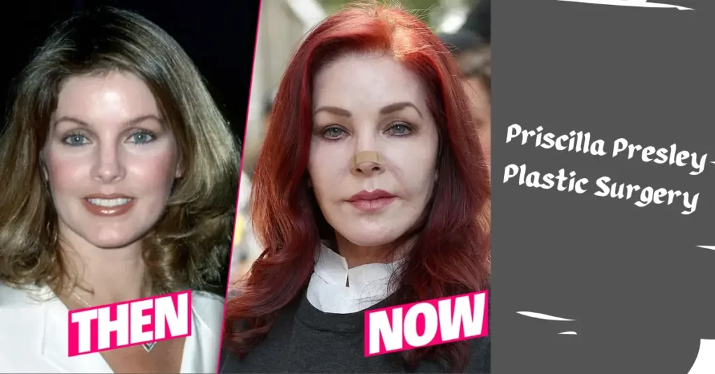 Priscilla Presley Plastic Surgery