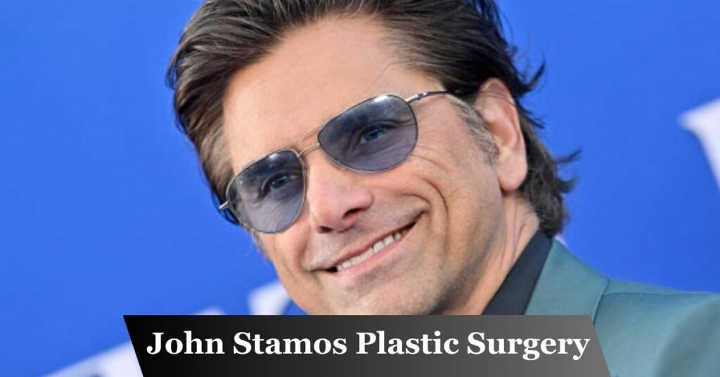 John Stamos Plastic Surgery